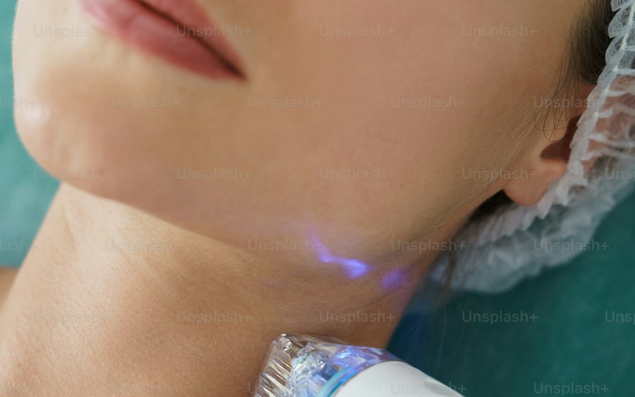 Radiofrecuencia facial y lifting dérmico con aparatología en Madrid Bienestar Chic