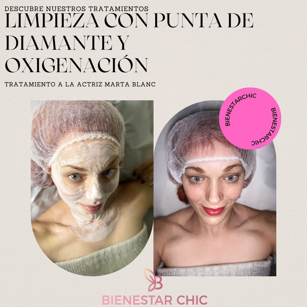 Estética de las famosas Madrid celebridades Bienestar Chic