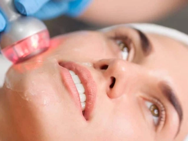 Radiofrecuencia con Mesoterapia Mesobiolift RÖSS en Madrid